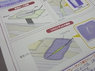手術中レーザーメス接触、やけどに注意をのサムネイル画像