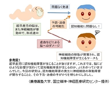 超早産児の認知機能障害に脳神経移動障害が関与