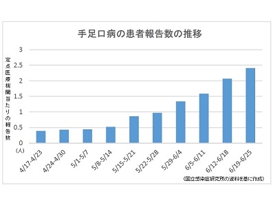 手足口病、高知など6県で警報レベルのサムネイル画像
