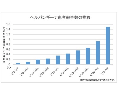 【感染症情報】ヘルパンギーナが9週連続増のサムネイル画像