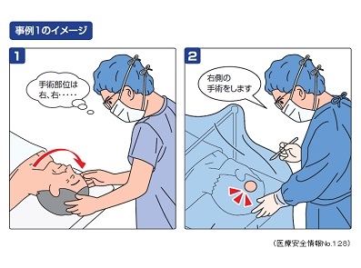 脳神経外科手術、左右の取り違え11件のサムネイル画像