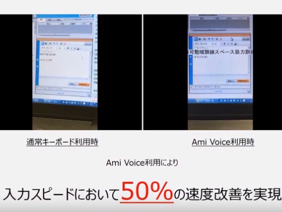 音声入力でカルテ入力時間が約半分にのサムネイル画像