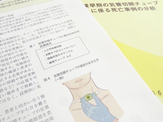 気管切開術後早期の体位変換、接続器具など取り外しをのサムネイル画像