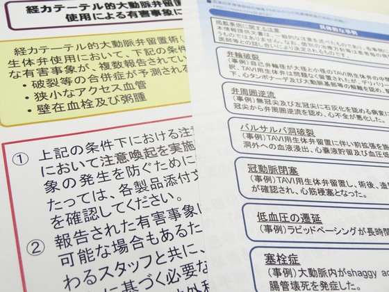 経カテーテル的大動脈弁留置術の生体弁で塞栓症などのサムネイル画像