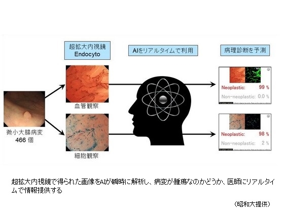 AIホスピタル実現へ　医療現場で診断の“実績”のサムネイル画像