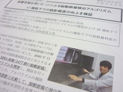 脳動脈瘤、AI補助で放射線科医の読影精度向上のサムネイル画像