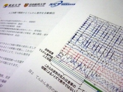 てんかん発作、脳波から自動検出できるAI開発のサムネイル画像