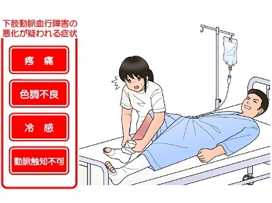 弾性ストッキング着用し手術、下肢に疼痛出現のサムネイル画像