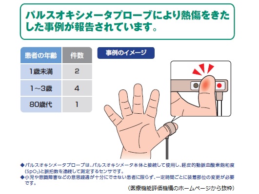 パルスオキシメータプローブで低温熱傷ものサムネイル画像