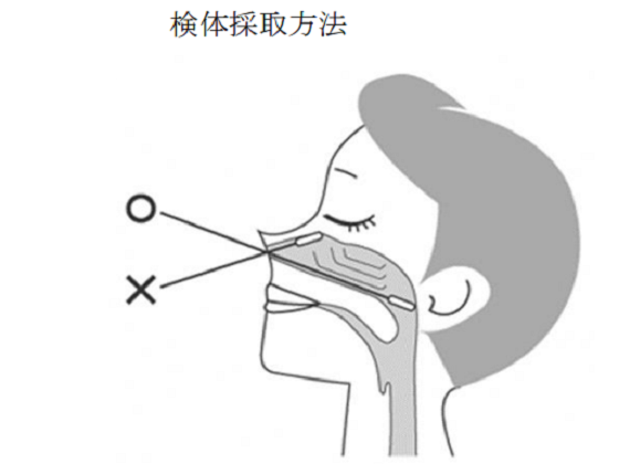新型コロナの抗原検査キットは600点のサムネイル画像