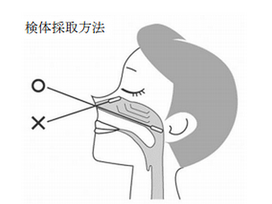 コロナ抗原診断キット、供給先の優先付けを撤廃のサムネイル画像