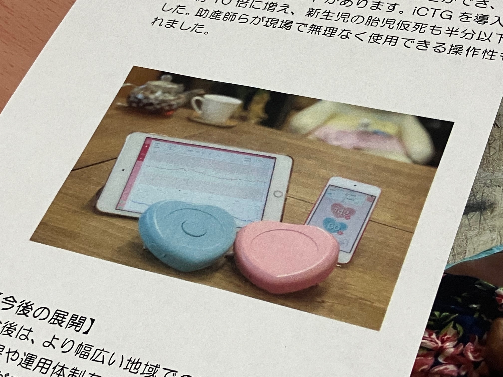 モバイル胎児心拍モニター、低リソース環境でも効果のサムネイル画像