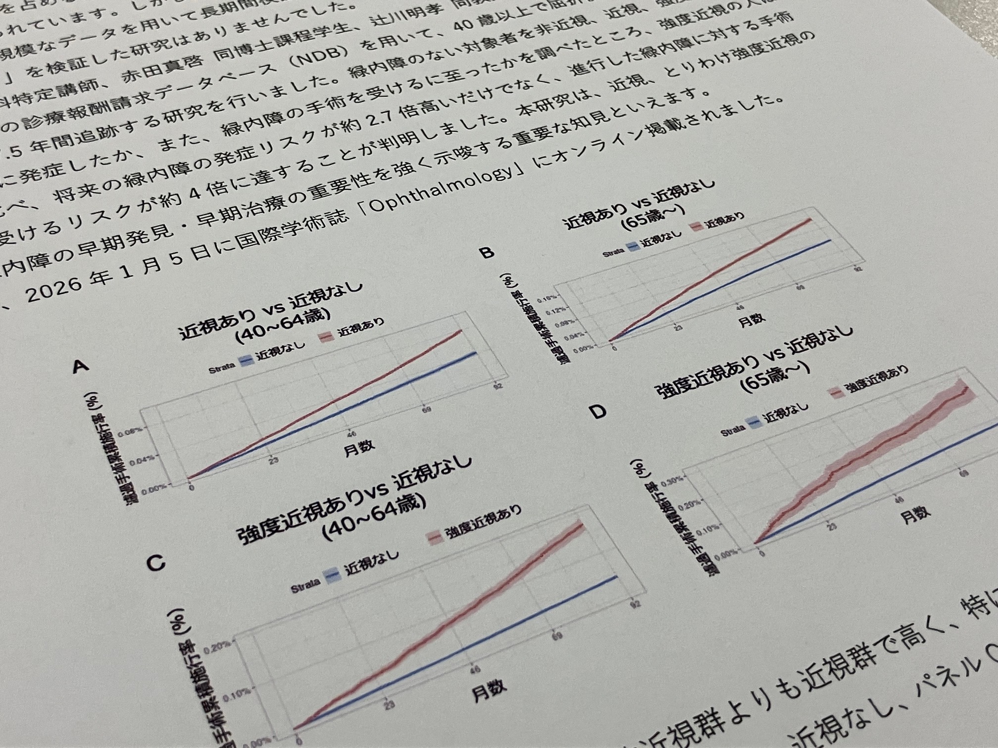 強度近視　緑内障手術リスク最大4倍にのサムネイル画像