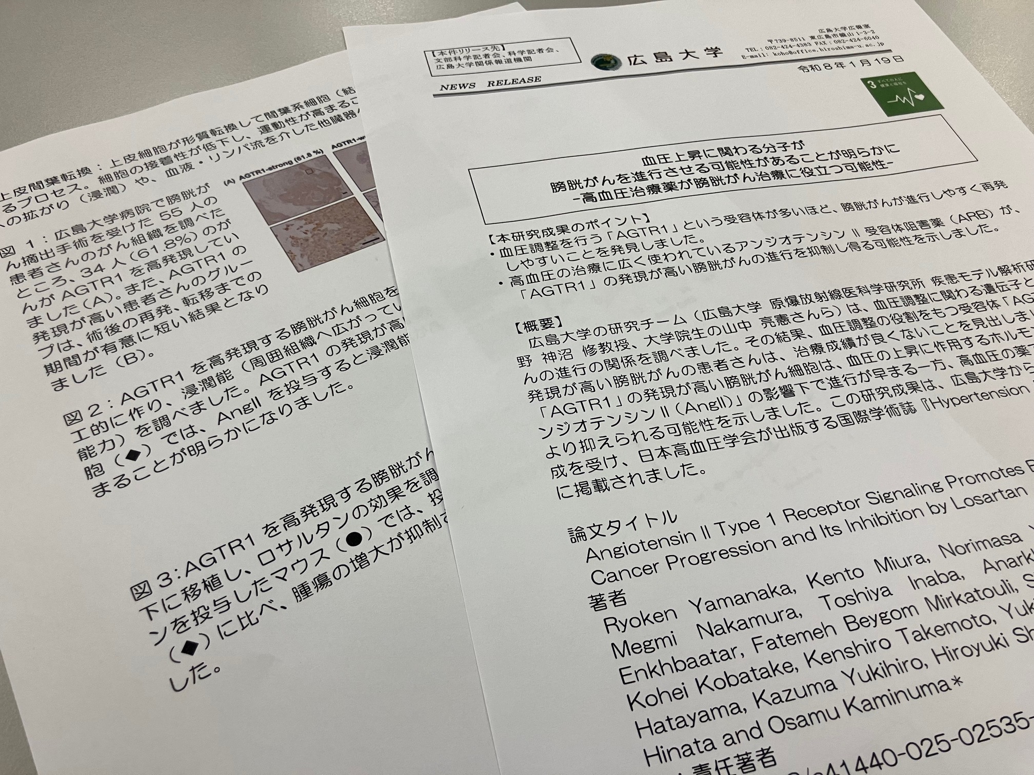 膀胱がん、血圧上昇に関わる分子が進行させる可能性のサムネイル画像