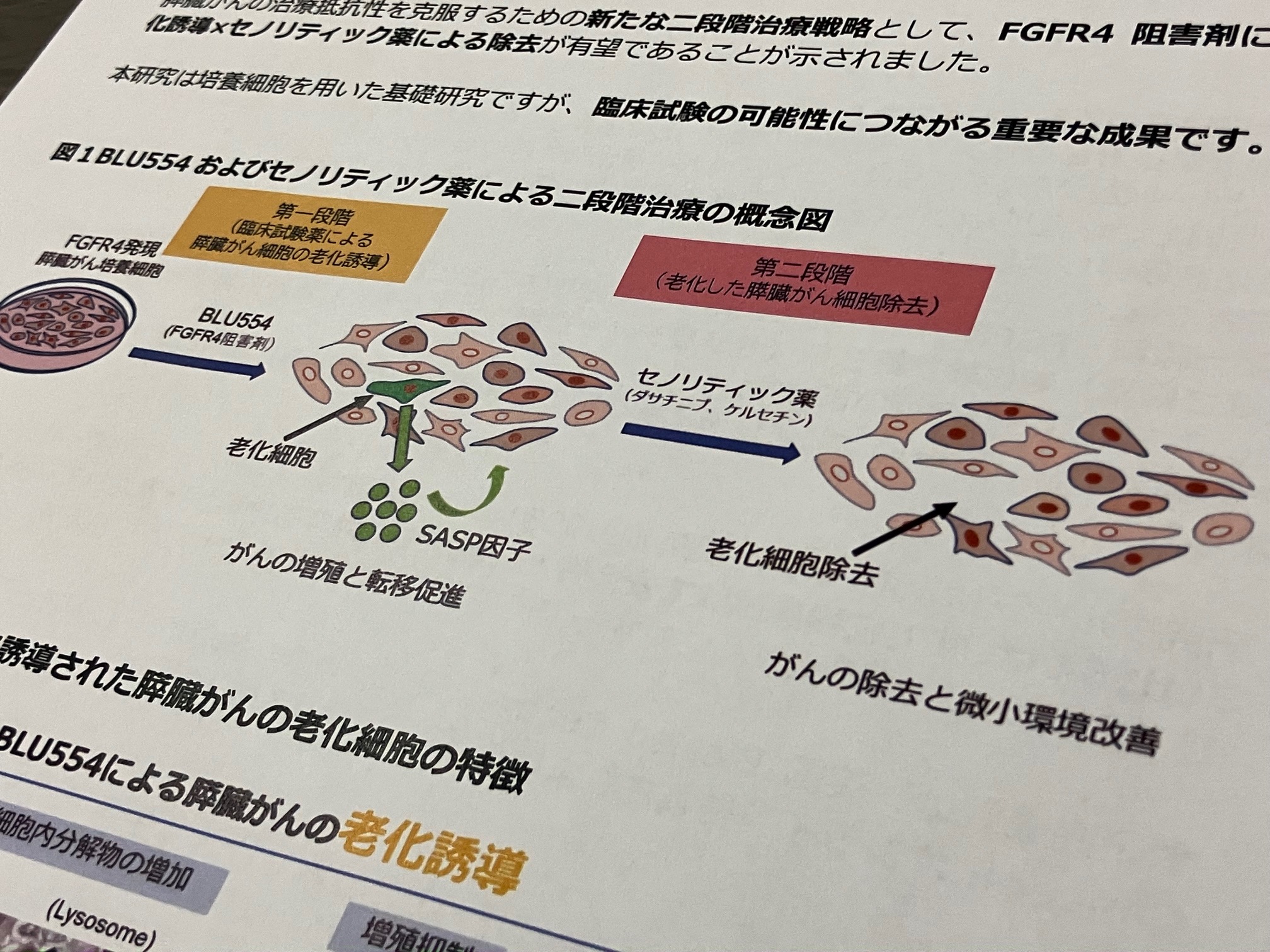 難治性膵臓がん　二段階治療で効果を確認のサムネイル画像