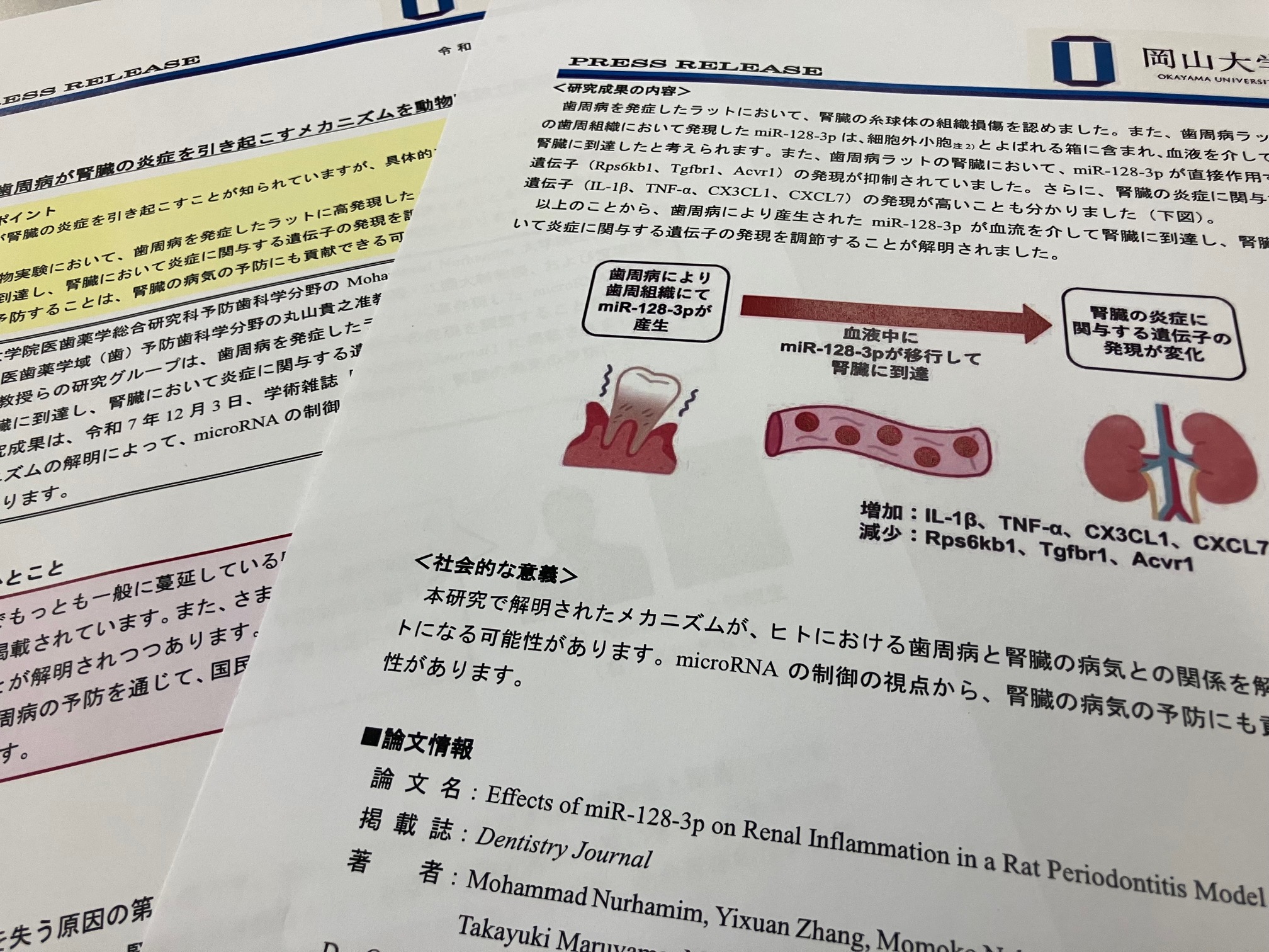 歯周病が腎臓の炎症を引き起こすメカニズム解明のサムネイル画像