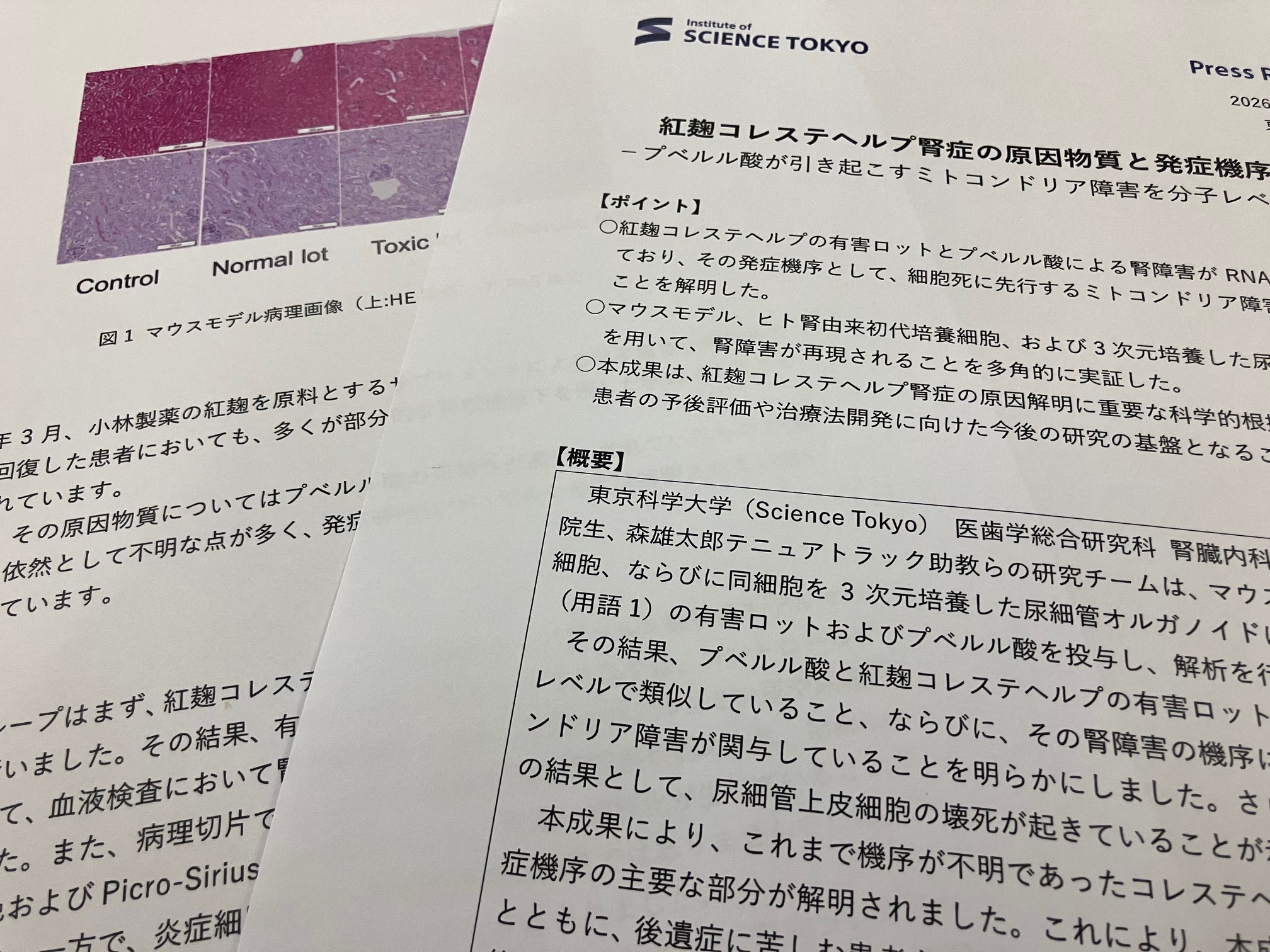 紅麹サプリによる腎障害　発症機序を解明のサムネイル画像