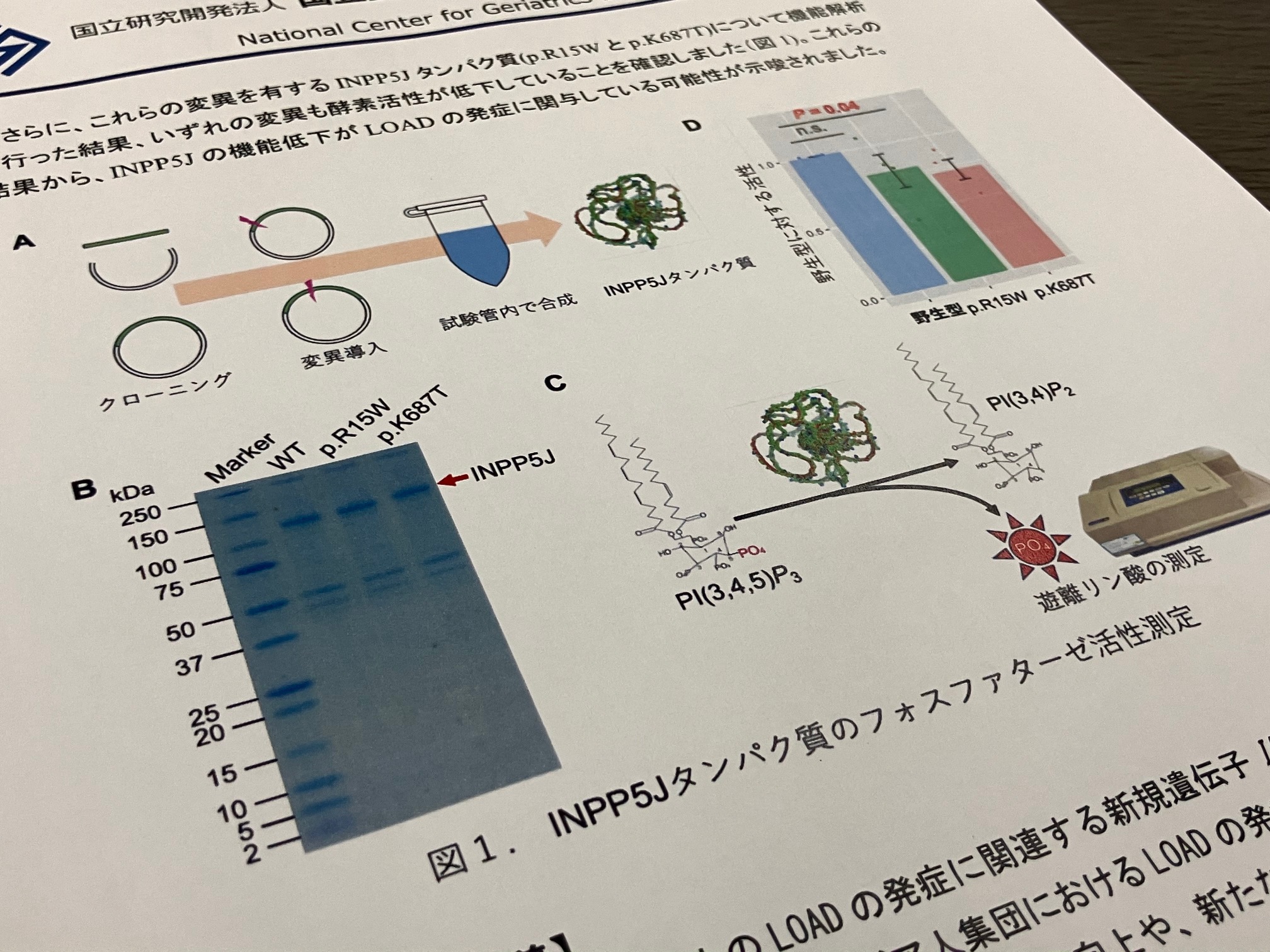 アルツハイマー病のリスク遺伝子変異を発見のサムネイル画像