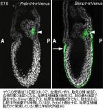 「不妊治療」へ新発見のサムネイル画像