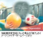 加齢による目の疾患治療剤承認のサムネイル画像