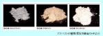 「中皮腫」の死者、大阪が7年連続最多のサムネイル画像