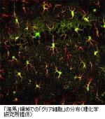 アルツハイマー病などの治療薬開発に期待のサムネイル画像